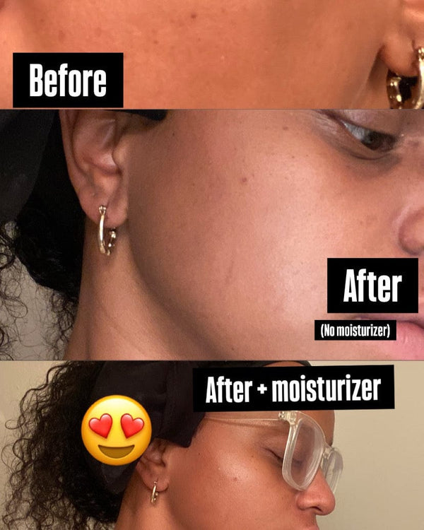 Before and after comparison of a person's neck with and without moisturizer.