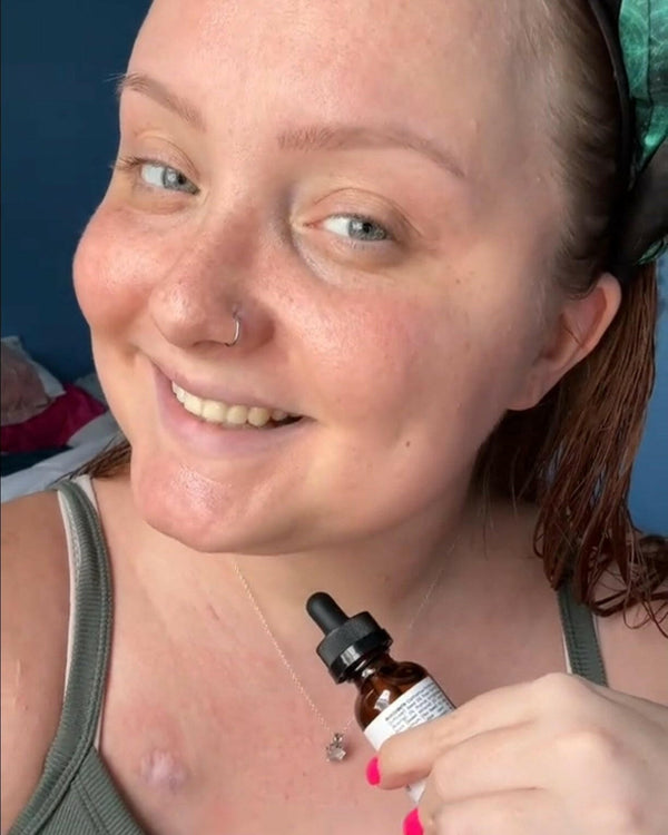 Woman holding a bottle with a dropper, possibly a supplement or medical product, against a blue wall.